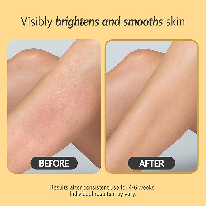 Exfoliating Turmeric Scrub and Skin Exfoliator with Collagen and Coconut Oil, Gently Exfoliates Face, Body, Hands, and Feet, Moisturizing Skincare, 16 oz by M3